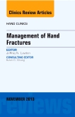 Management of Hand Fractures, An Issue of Hand Clinics