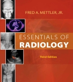 cover image - Essentials of Radiology - Elsevier eBook on VitalSource,3rd Edition