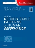 Smiths Recognizable Patterns of Human Deformation