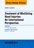 Treatment of Mutilating Hand Injuries: An International Perspective, An Issue of Hand Clinics