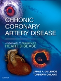 Chronic Coronary Artery Disease: A Companion to Braunwalds Heart Disease E-Book