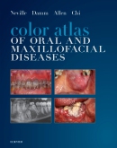 cover image - Color Atlas of Oral and Maxillofacial Diseases Elsevier eBook on VitalSource