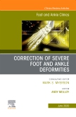 Correction of Severe Foot and Ankle Deformities, An issue of Foot and Ankle Clinics of North America