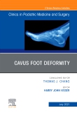 Cavus Foot Deformity, An Issue of Clinics in Podiatric Medicine and Surgery, E-Book