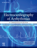 Electrocardiography of Arrhythmias: A Comprehensive Review E-Book