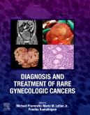 Diagnosis and Treatment of Rare Gynecologic Cancers - E-Book