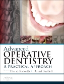 cover image - Advanced Operative Dentistry