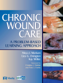 Chronic Wound Care E-Book