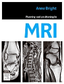 cover image - Evolve Resources for Planning and Positioning in MRI