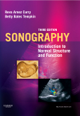 cover image - Sonography,3rd Edition
