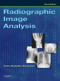 cover image - Radiographic Image Analysis,3rd Edition