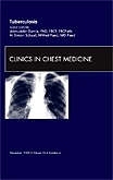 Tuberculosis, An Issue of Clinics in Chest Medicine