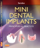 cover image - Mini Dental Implants