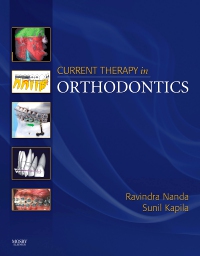 cover image - Current Therapy in Orthodontics,1st Edition