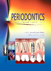 cover image - Periodontics - Elsevier eBook on VitalSource,1st Edition