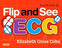 cover image - Flip and See ECG - Elsevier eBook on VitalSource,4th Edition