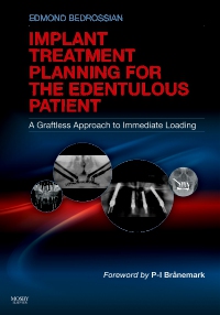 cover image - Implant Treatment Planning for the Edentulous Patient - Elsevier eBook on VitalSource,1st Edition