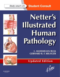 cover image - Netter's Illustrated Human Pathology Updated Edition,1st Edition