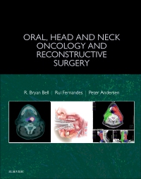 cover image - Oral, Head and Neck Oncology and Reconstructive Surgery - Elsevier eBook on VitalSource