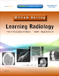 cover image - Learning Radiology Elsevier eBook on VitalSource,2nd Edition