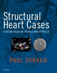 cover image - Evolve Resources for Structural Heart Cases