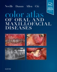 cover image - Color Atlas of Oral and Maxillofacial Diseases