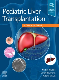 cover image - Pediatric Liver Transplantation,1st Edition