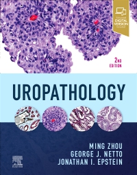 cover image - Uropathology,2nd Edition