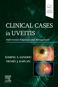 cover image - Clinical Cases in Uveitis,1st Edition