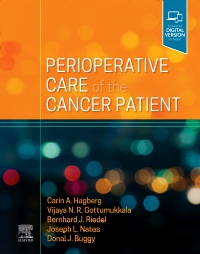 cover image - Perioperative Care of the Cancer Patient,1st Edition