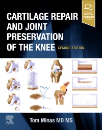 cover image - Cartilage Repair and Joint Preservation of the Knee,2nd Edition