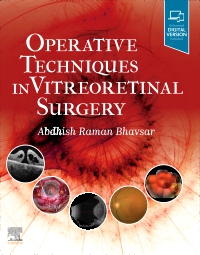 cover image - Operative Techniques in Vitreoretinal Surgery,1st Edition