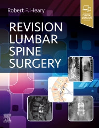 cover image - Revision Lumbar Spine Surgery,1st Edition