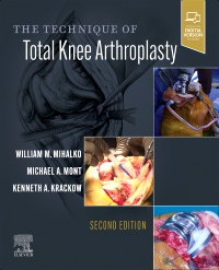 cover image - The Technique of Total Knee Arthroplasty,2nd Edition
