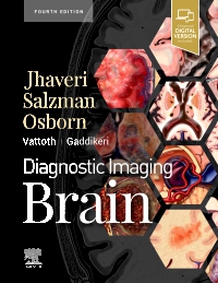 cover image - Diagnostic Imaging: Brain,4th Edition