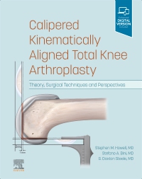 cover image - Calipered Kinematically aligned Total Knee Arthroplasty,1st Edition