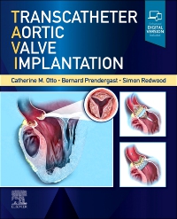 cover image - Transcatheter Aortic Valve Implantation,1st Edition