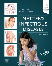 cover image - Netter's Infectious Diseases - Elsevier E-Book on VitalSource,2nd Edition