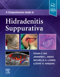 cover image - A Comprehensive Guide to Hidradenitis Suppurativa,1st Edition