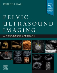 cover image - Pelvic Ultrasound Imaging,1st Edition