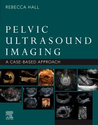cover image - Pelvic Ultrasound Imaging, E-Book,1st Edition