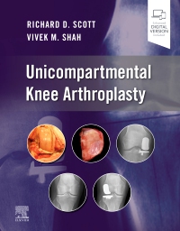 cover image - Unicompartmental Knee Arthroplasty,1st Edition
