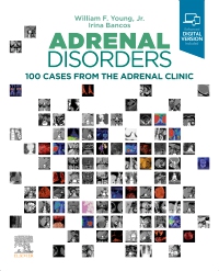 cover image - Adrenal Disorders,1st Edition