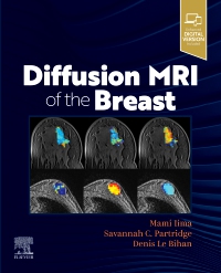 cover image - Diffusion MRI of the Breast,1st Edition