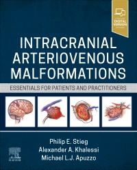 cover image - Intracranial Arteriovenous Malformations,1st Edition