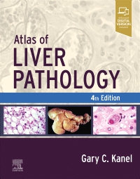 cover image - Atlas of Liver Pathology,4th Edition