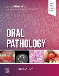 cover image - Oral Pathology,3rd Edition