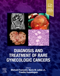 cover image - Diagnosis and Treatment of Rare Gynecologic Cancers,1st Edition