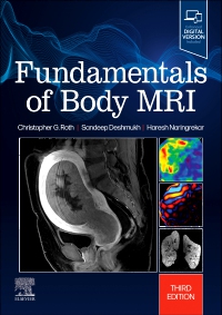 cover image - Fundamentals of Body MRI, 3rd Edition