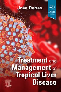 cover image - Treatment and Management of Tropical Liver Disease,1st Edition